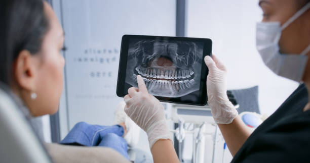 Licensed Tooth Extraction service in Santa Monica, CA - Smile Center Dentistry